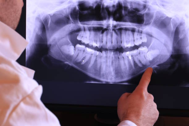 Best Emergency Cosmetic Dentistry in Gas City, IN