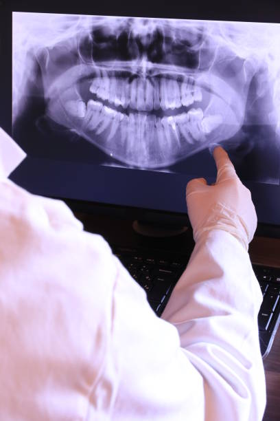 Best Emergency Root Canal Treatment in Gas City, IN